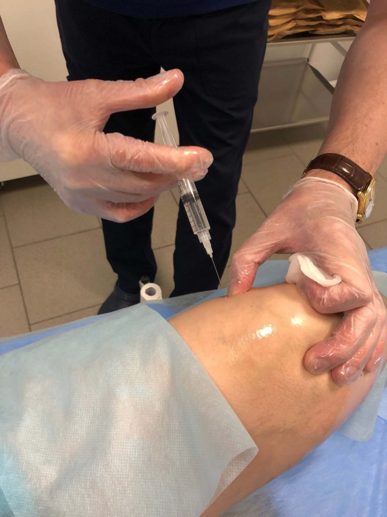 Пролотерапия в Москве. Пролотерапия в лечении суставов