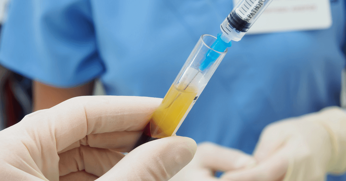 syringe-blood-test-tube-1